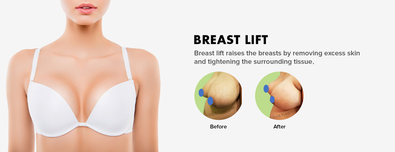 breast lift surgery in Delhi