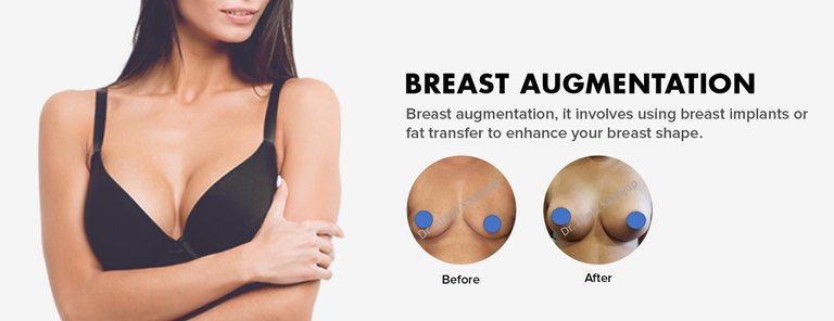 breast augmentation surgery in Delhi